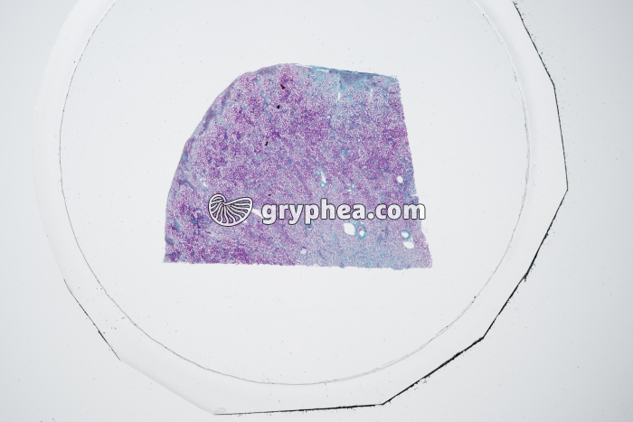 Rein zone corticale sur préparation x5 - gryphea.com